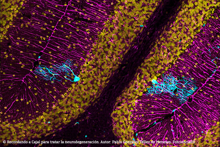 Recordando a Cajal para tratar la neurodegeneración